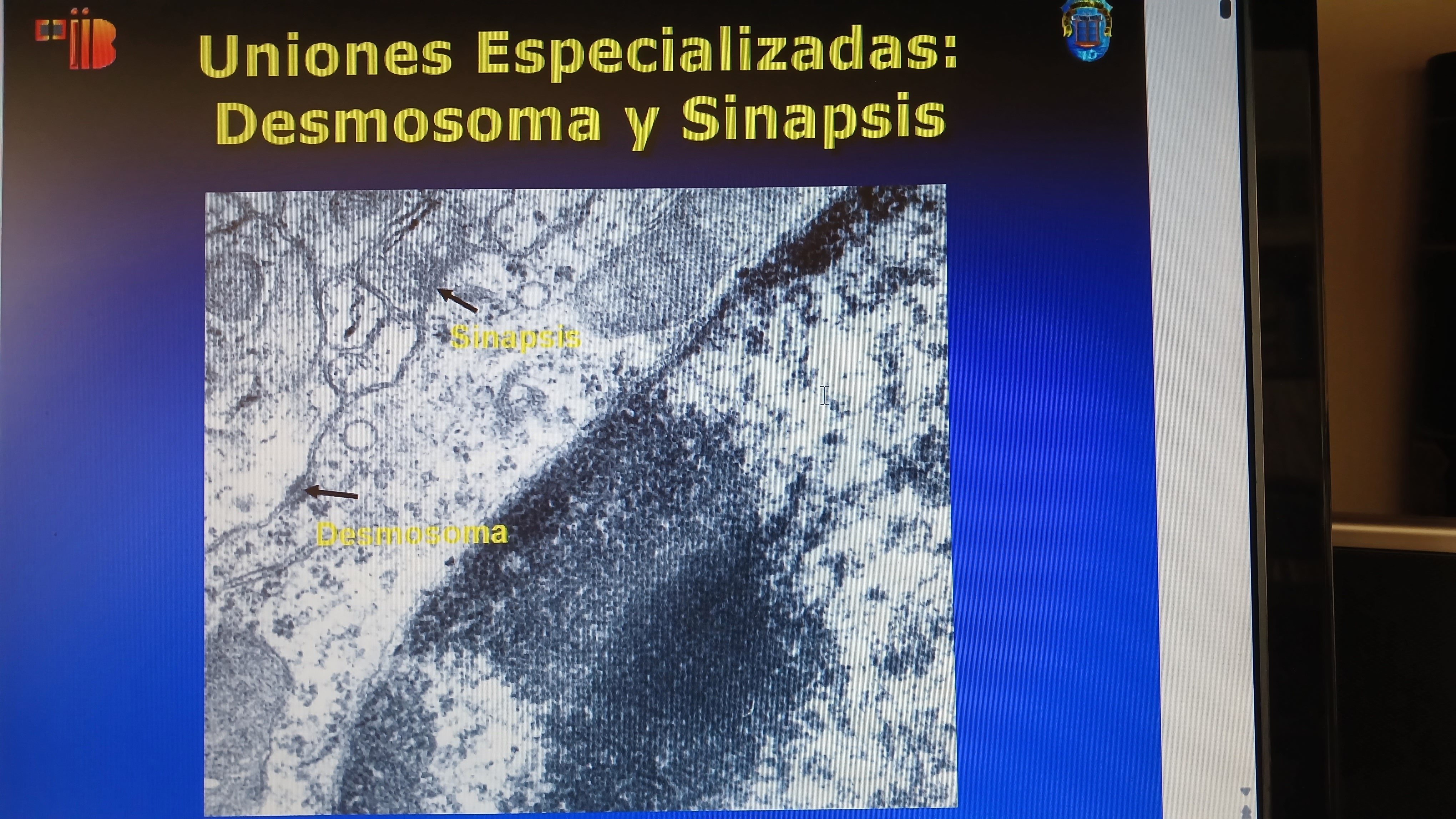 CURSO TALLER DE APLICACIONES DE MICROSCOPÍA ELECTRÓNICA EN CIENCIAS BIOMÉDICAS . NEUROBIOLOGÍA Y EDEMA CEREBRAL  01 DE FEBRERO HORARIO   09:00AM A 12:00M